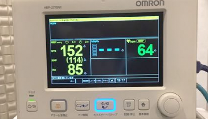 生体情報モニター