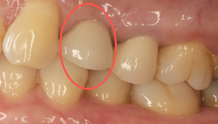 綺麗な白い歯