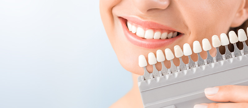 選べる3つのホワイトニングプラン